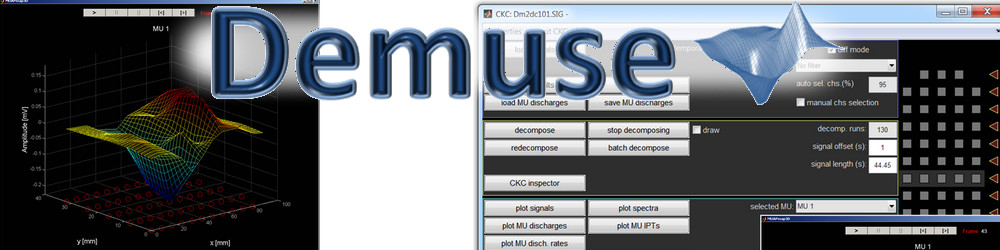 DEMUSE - software for decomposition of multichannel surface electromyograms